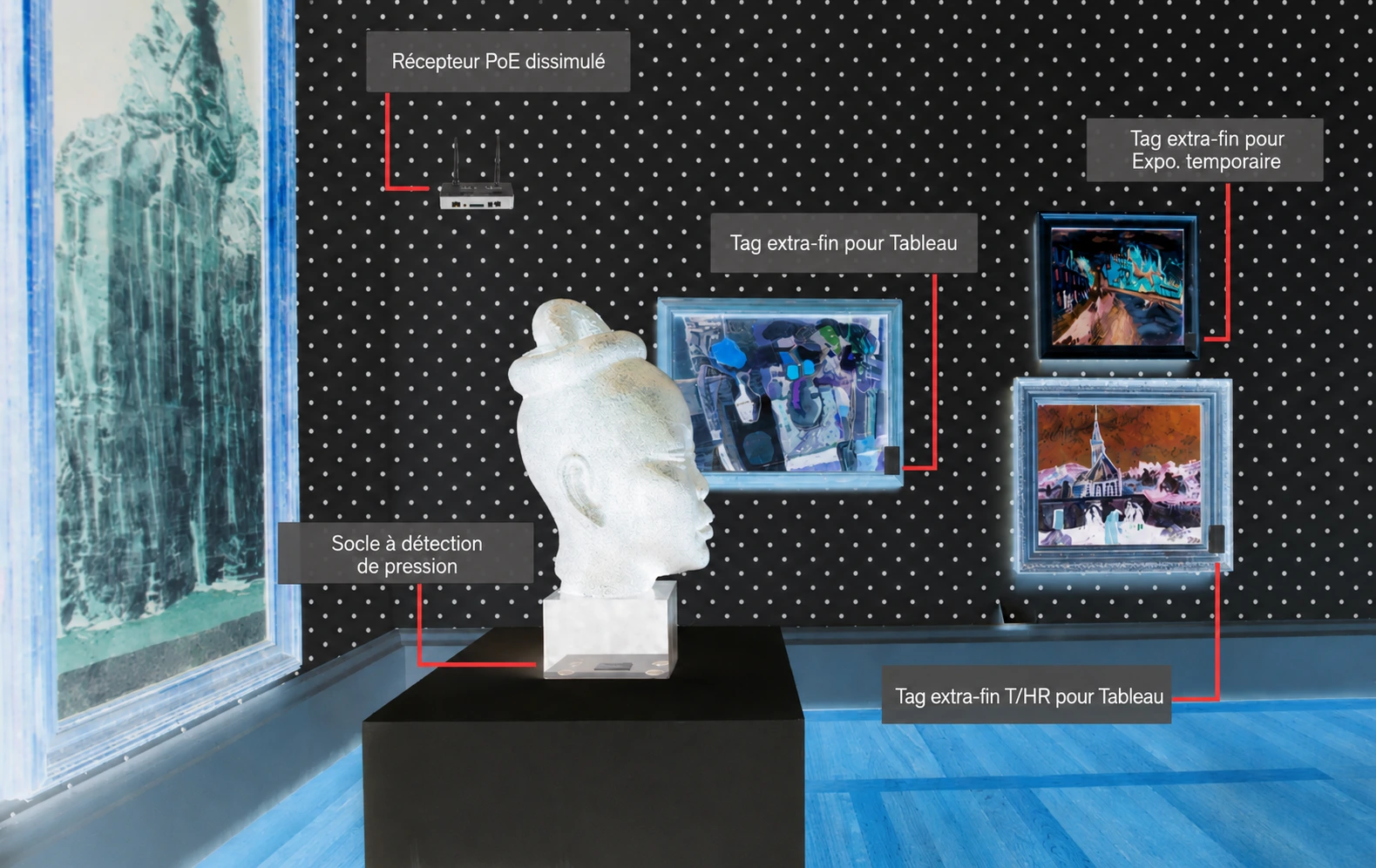 Arts_XRAY_FR